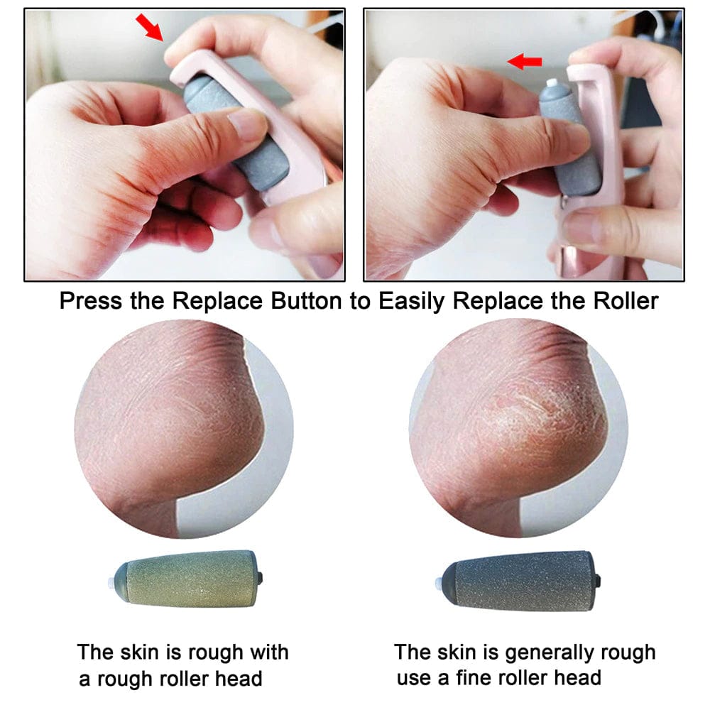 Electric Foot Callus Remover